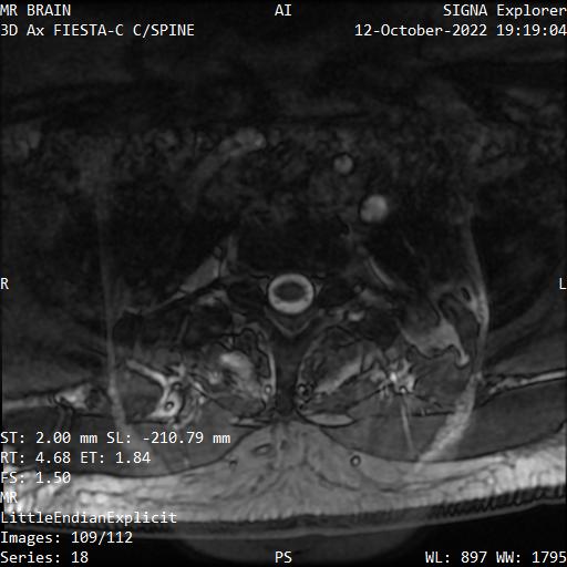 Series 018 image 109