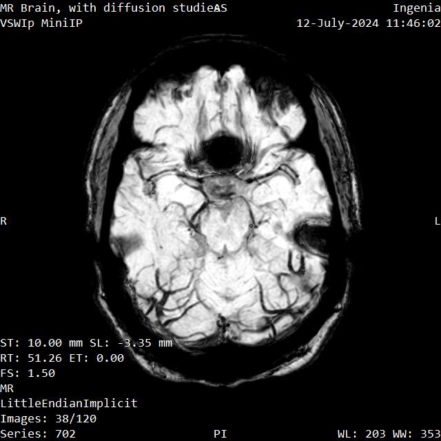 Series 702 image 38