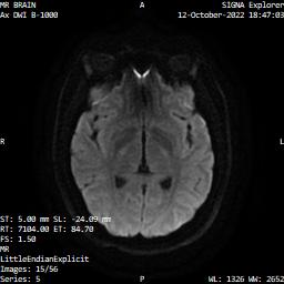 Series 005 image 15