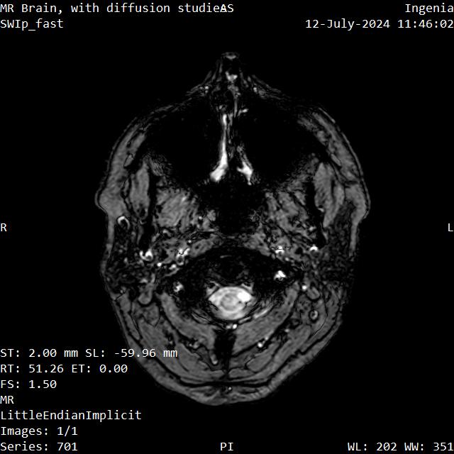 Series 701 image 1
