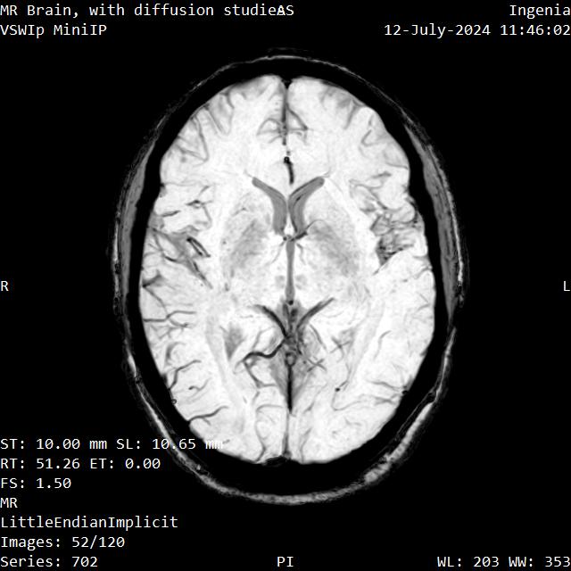 Series 702 image 52