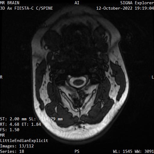 Series 018 image 13