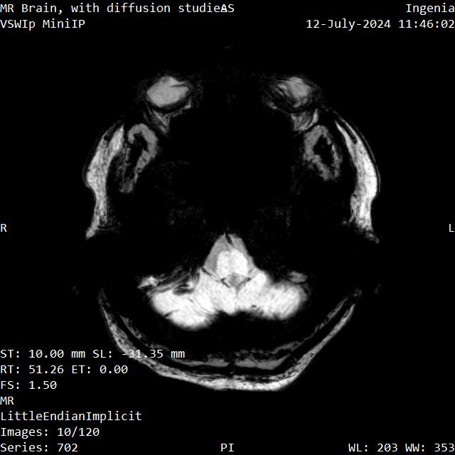 Series 702 image 10