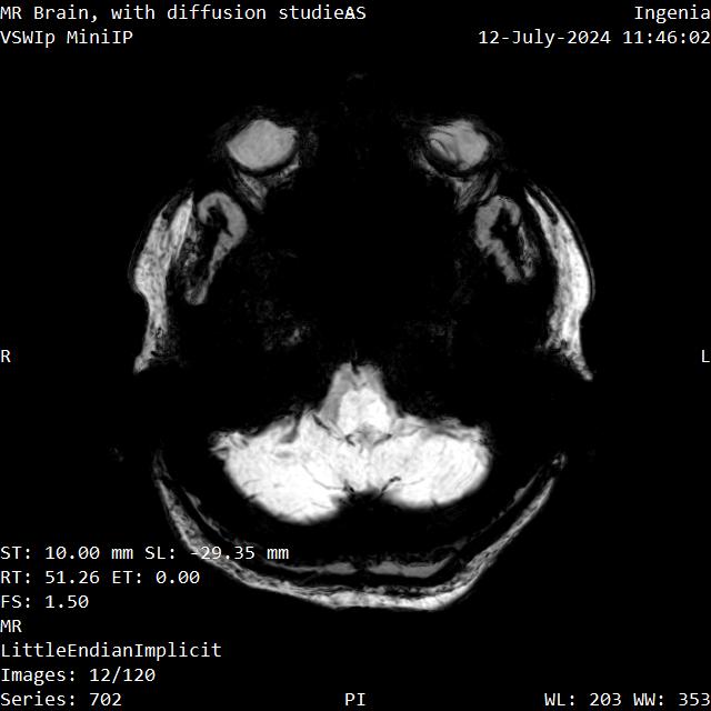 Series 702 image 12