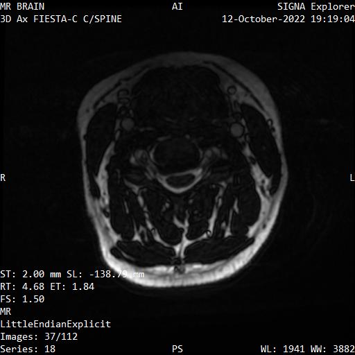 Series 018 image 37