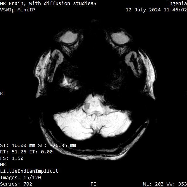 Series 702 image 15