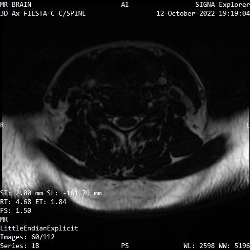 Series 018 image 60