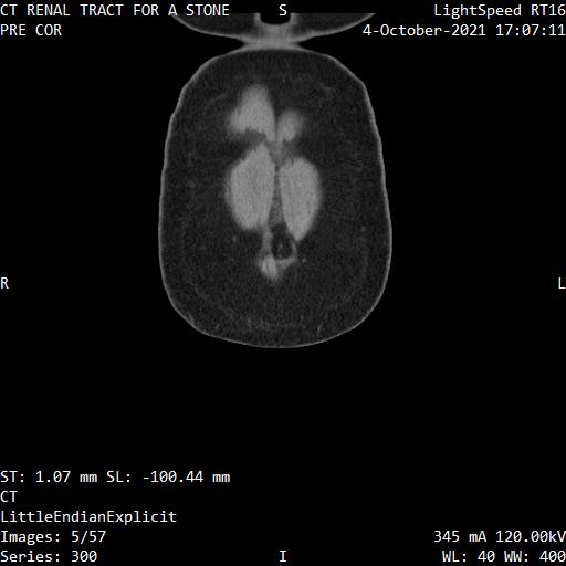 Series 300 image 5