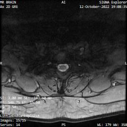 Series 014 image 15