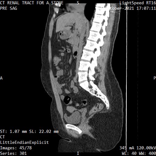 Series 301 image 45