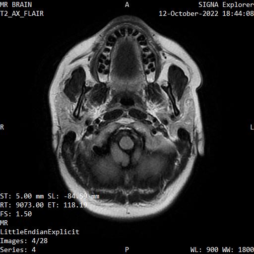 Series 004 image 4