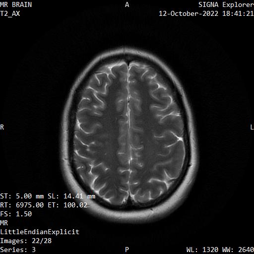 Series 003 image 22