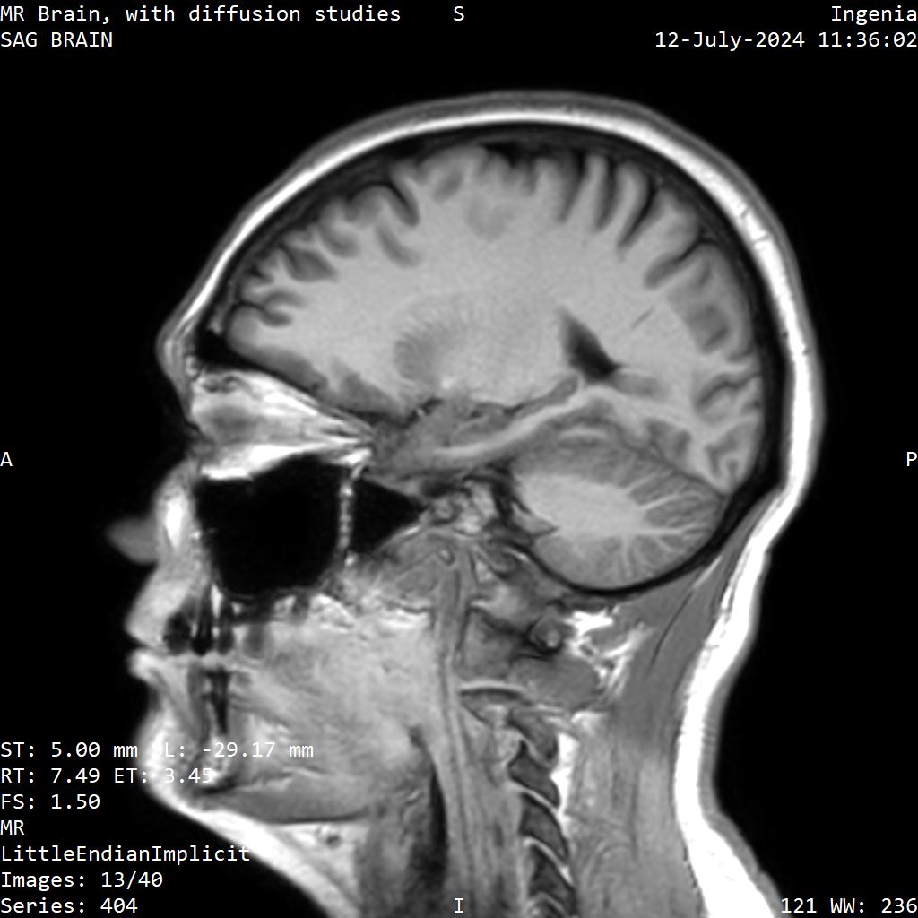Series 404 image 13