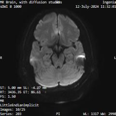 Series 203 image 10
