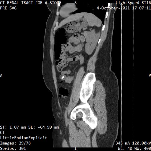 Series 301 image 29