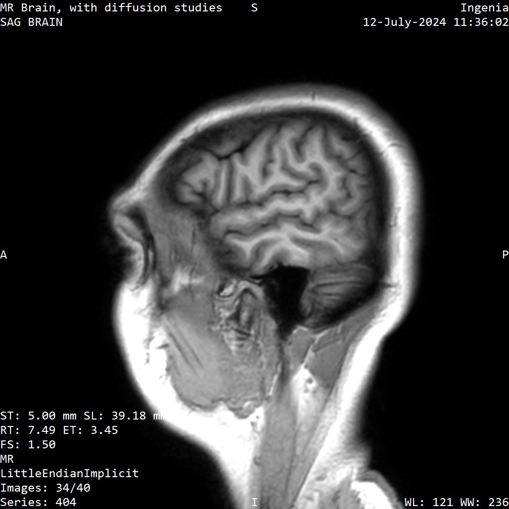 Series 404 image 34