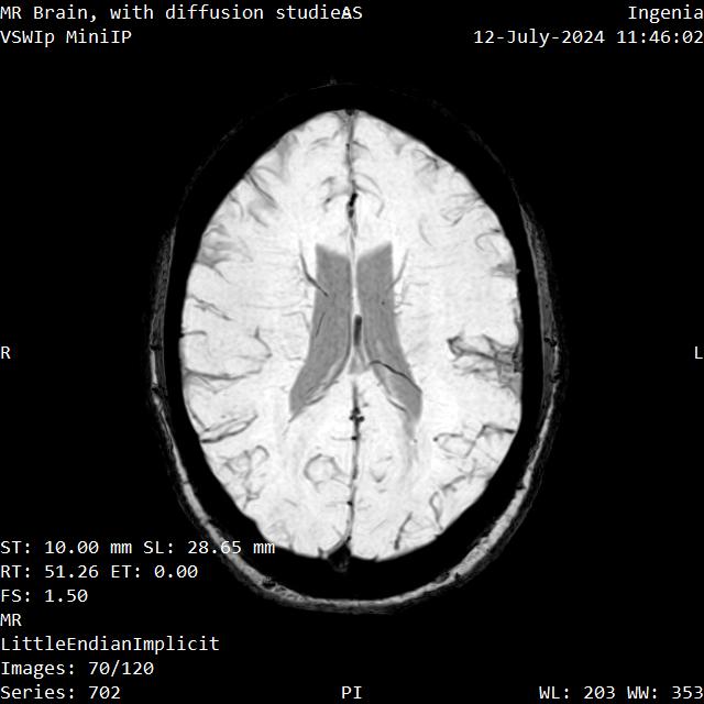 Series 702 image 70
