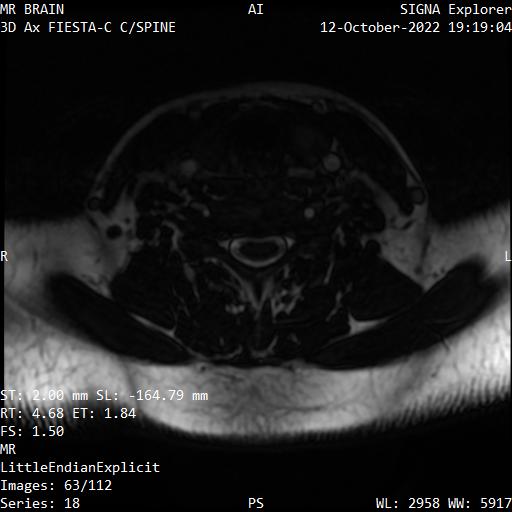 Series 018 image 63
