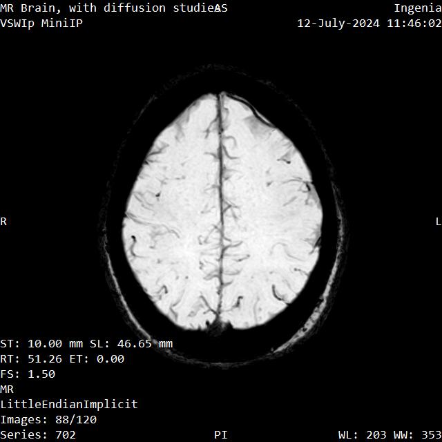 Series 702 image 88