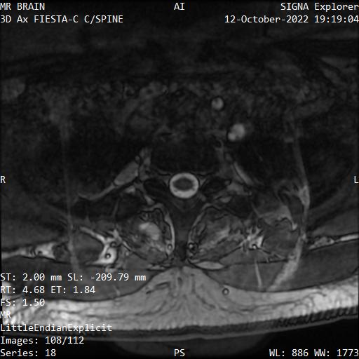 Series 018 image 108