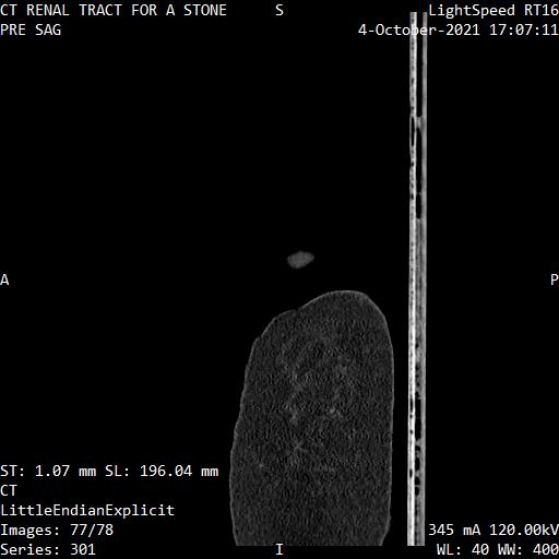 Series 301 image 77