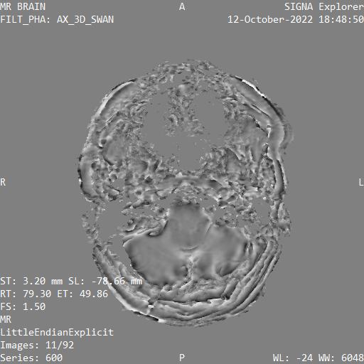 Series 600 image 11