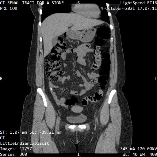 Series 300 image 17