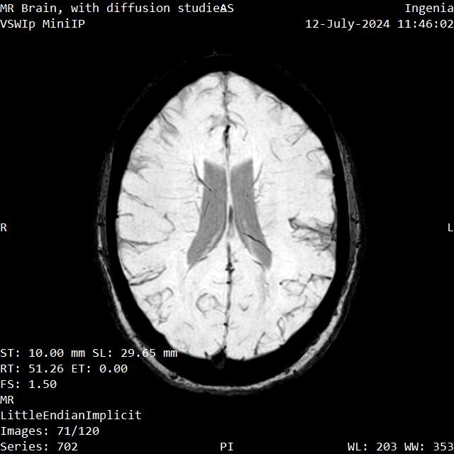 Series 702 image 71