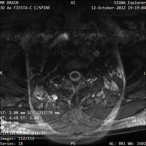 Series 018 image 112