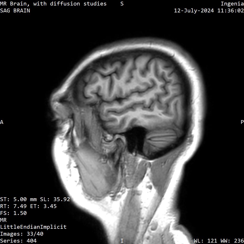 Series 404 image 33