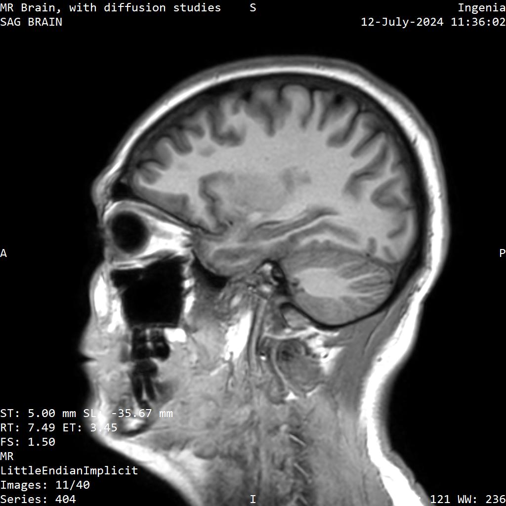 Series 404 image 11