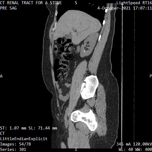 Series 301 image 54