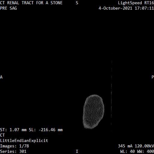 Series 301 image 1