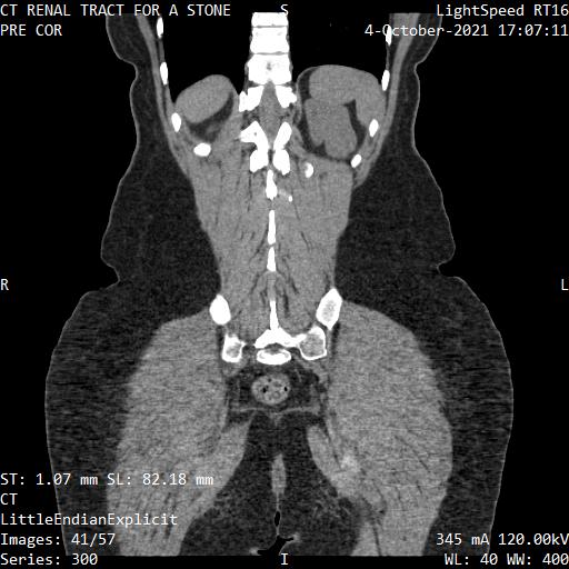 Series 300 image 41