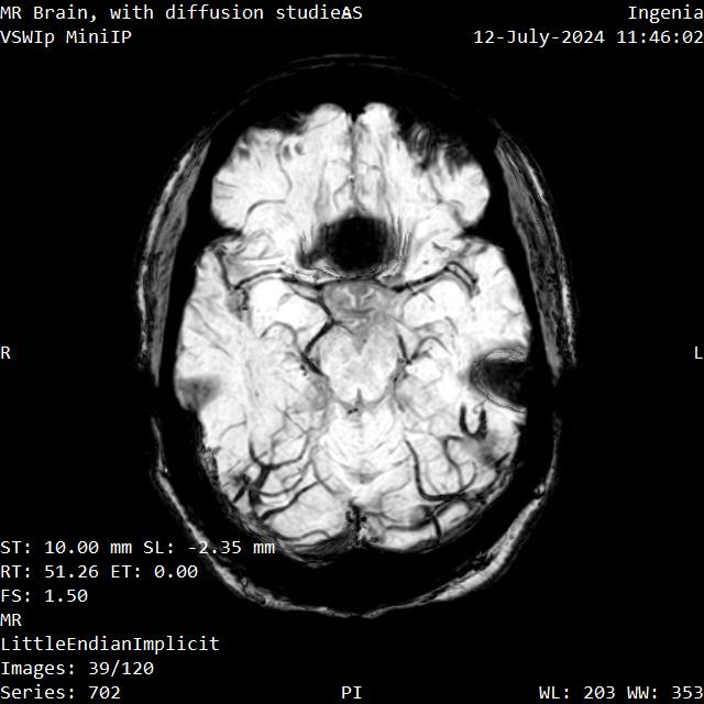 Series 702 image 39