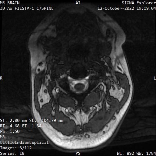 Series 018 image 3