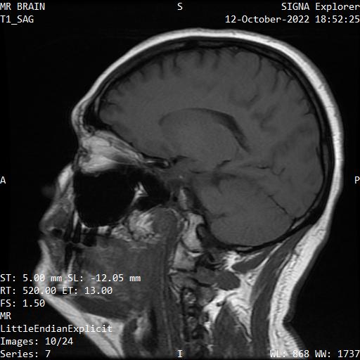 Series 007 image 10