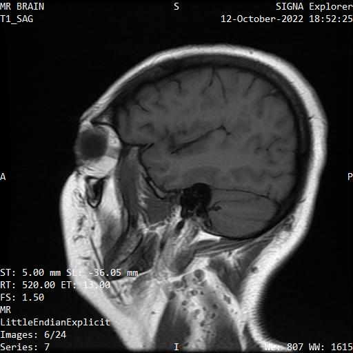 Series 007 image 6