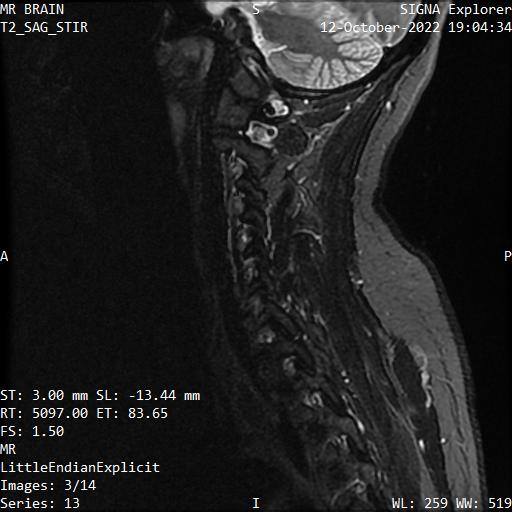 Series 013 image 3