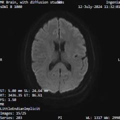 Series 203 image 15