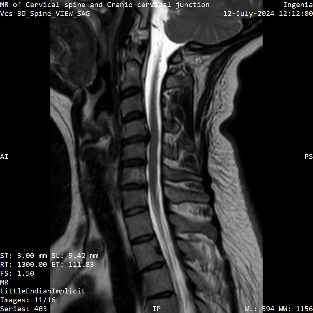 Series 403 image 11