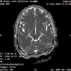 Series 204 image 11