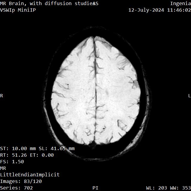 Series 702 image 83