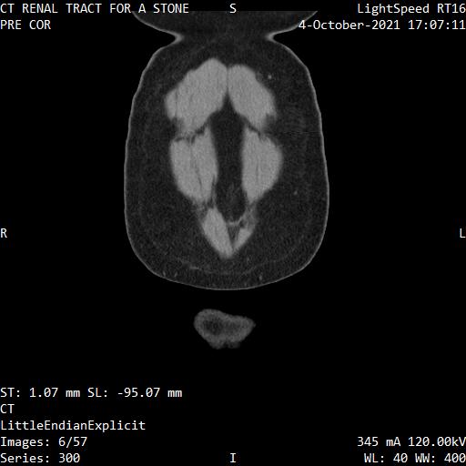 Series 300 image 6