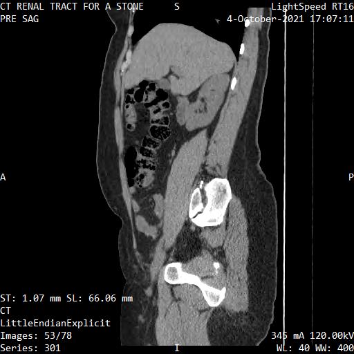 Series 301 image 53