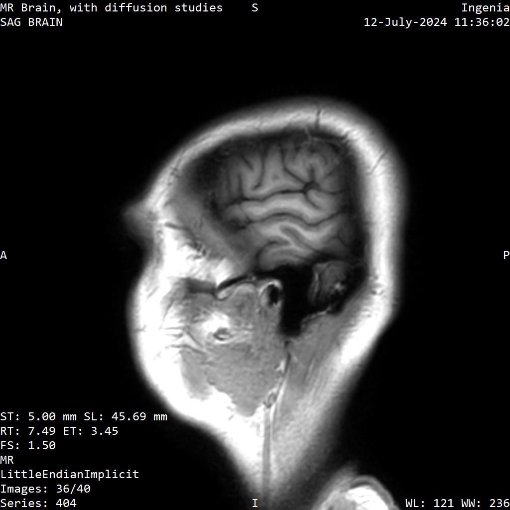 Series 404 image 36