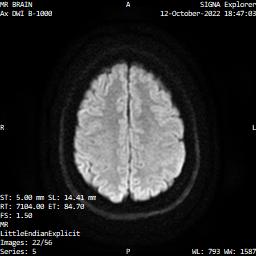 Series 005 image 22