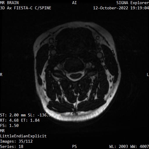 Series 018 image 35
