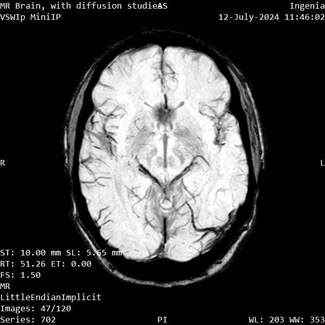 Series 702 image 47