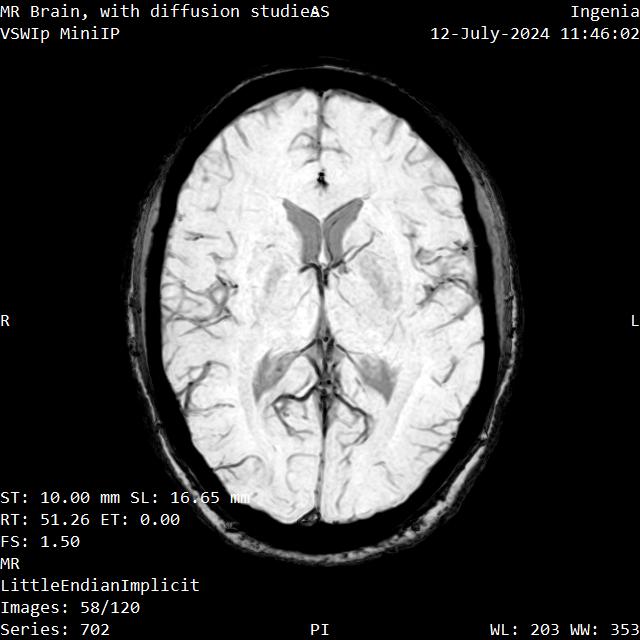 Series 702 image 58
